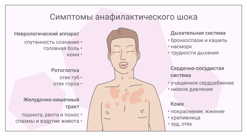 Аллергия после антибиотиков: симптомы, диагностика