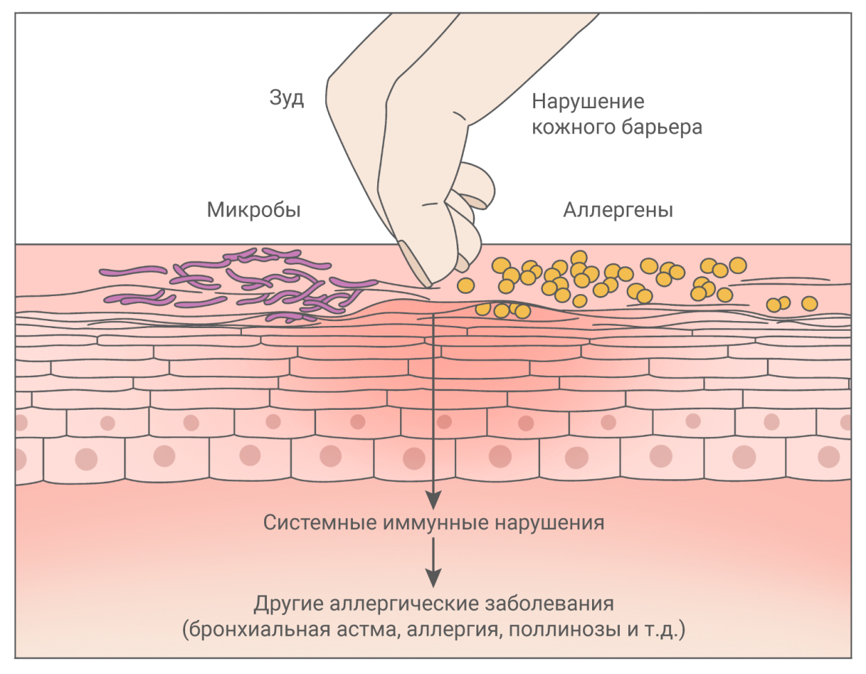 Почему Чешется Тело Фото