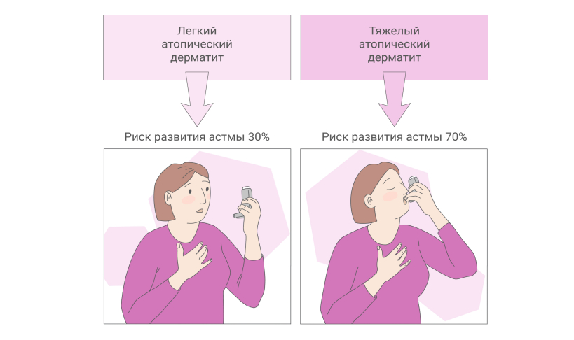Атопический дерматит и астма