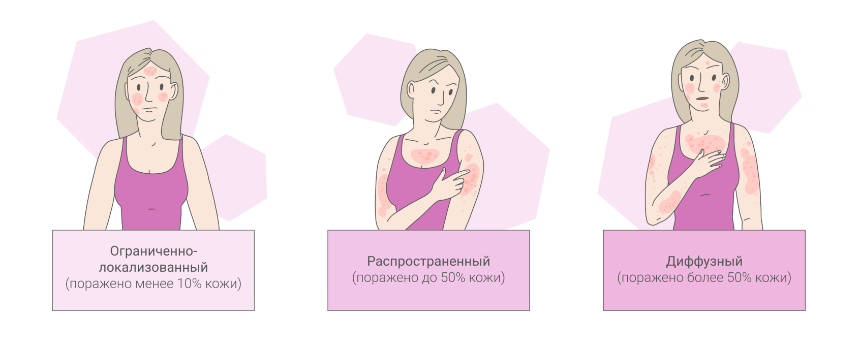 Атопический дерматит: всё о лечении и препаратах