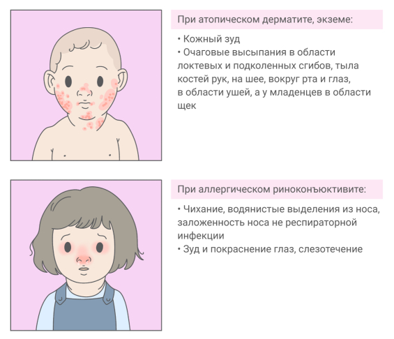 Симптомы аллергии у ребенка при атопическом дерматите и аллергическом риноконъюнктивите