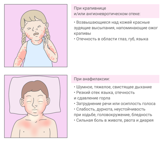 Симптомы аллергии у ребенка при крапивнице и анафилаксии