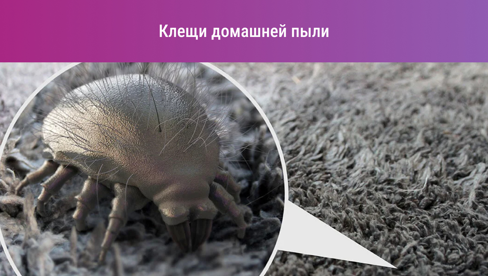 Аллергия на пыль: всё о симптомах и лечении